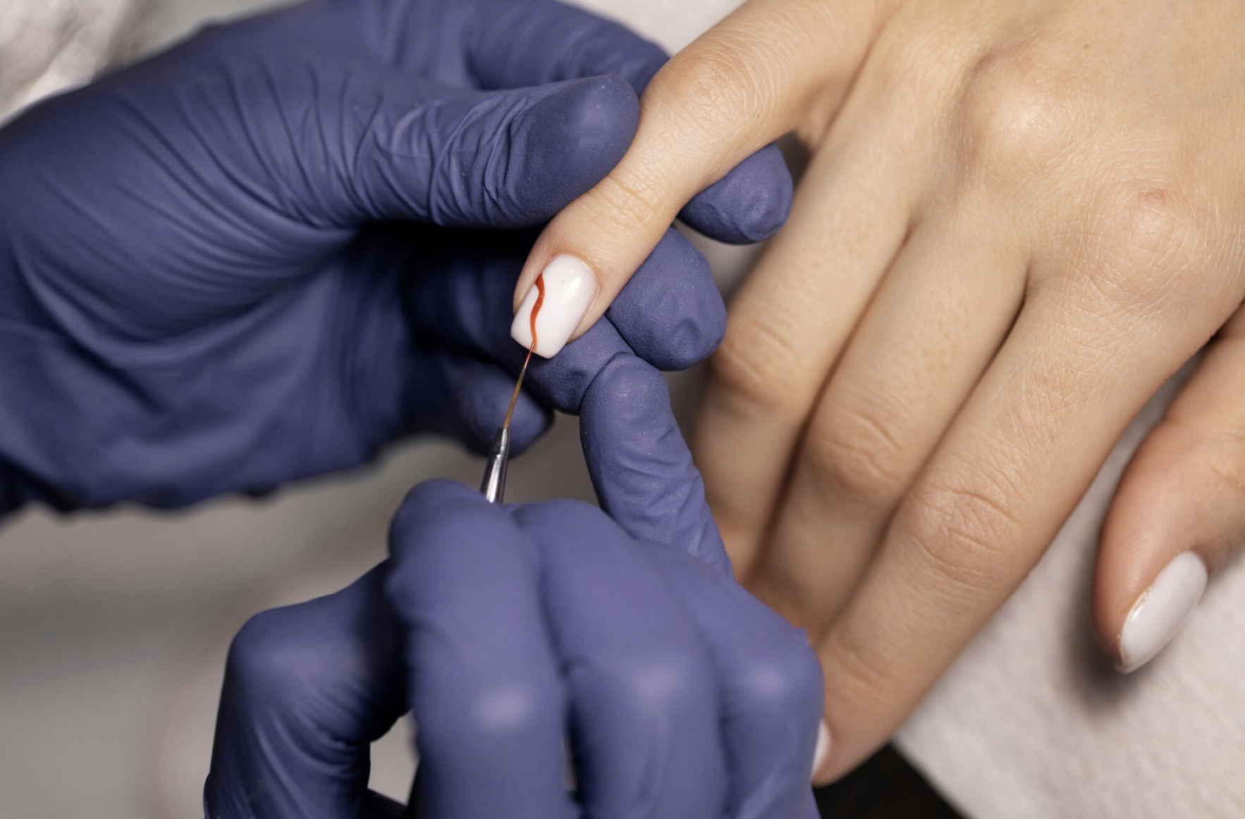 Nail Prosthetics